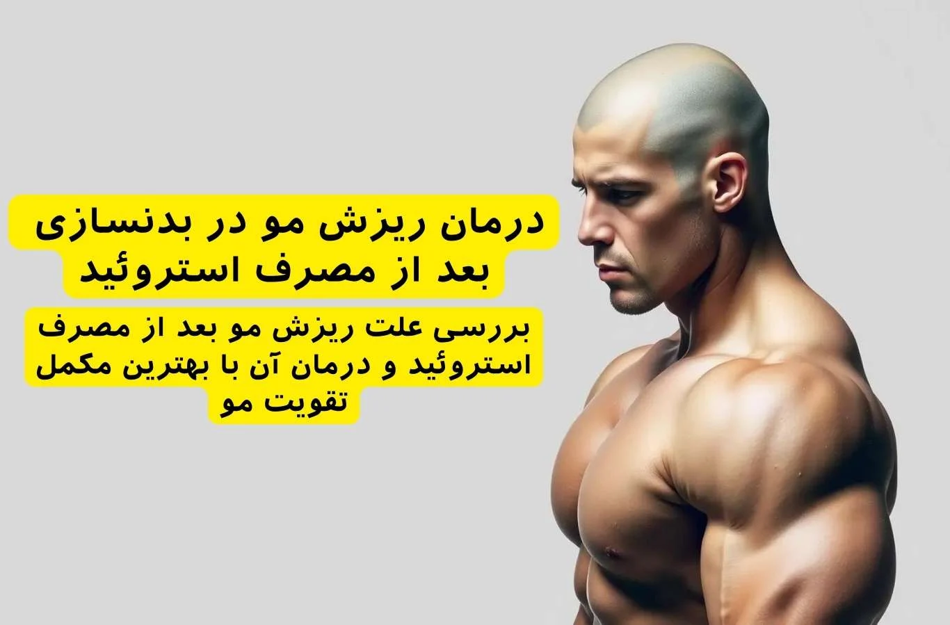 درمان | ریزش مو درمان ریزش مو ناشی از مصرف استروئید با مکمل فیتو | راهکارهای مؤثر