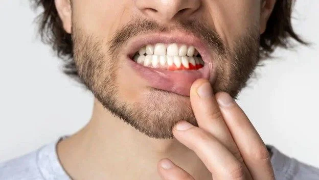 آیا قرص آموکسی کلاو برای عفونت دندان خوب است؟
