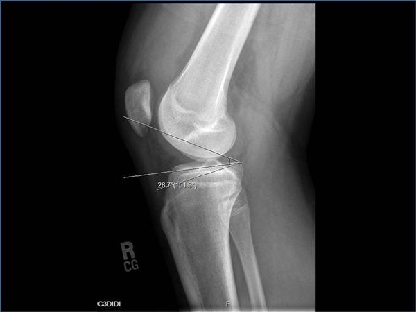 آیا می توان نتیجه MRI را بدون پزشک تفسیر کرد؟