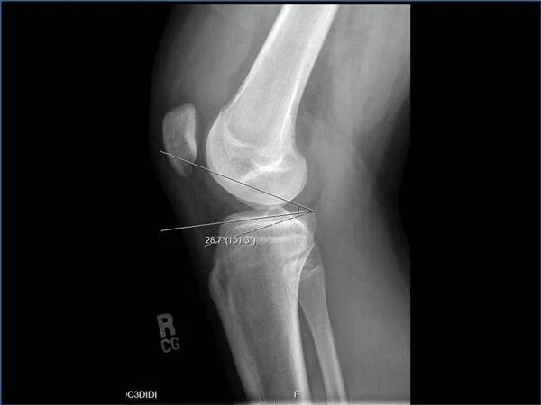 آیا می توان نتیجه MRI را بدون پزشک تفسیر کرد؟